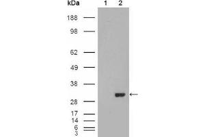 Western blot analysis using CA1 mouse mAb against HEK293T cells transfected with the pCMV6-ENTRY control (1) and pCMV6-ENTRY CA1 cDNA (2). (CA1 antibody  (AA 25-90))