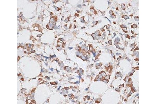 KIF14 antibody