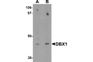 Western blot analysis of DBX1 in mouse kidney tissue lysate with DBX1 antibody at (A) 1 and (B) 2 µg/mL. (DBX1 antibody  (Middle Region))