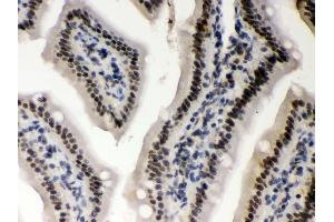 Anti- CSNK1A1 Picoband antibody,IHC(P) IHC(P): Mouse Intestine Tissue (CSNK1A1 antibody  (N-Term))