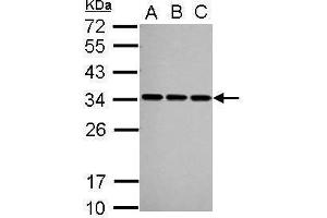 WB Image Sample (30 ug of whole cell lysate) A: A549 B: HeLa C: HepG2 12% SDS PAGE antibody diluted at 1:1000