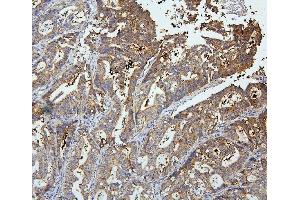 anti-Olfactomedin 4 (OLFM4) (AA 91-510) antibody