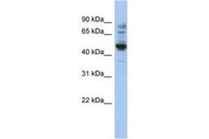 Image no. 1 for anti-Preferentially Expressed Antigen in Melanoma (PRAME) (AA 71-120) antibody (ABIN6743941) (PRAME antibody  (AA 71-120))