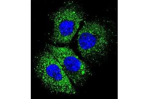 Confocal immunofluorescent analysis of CYBA Antibody (C-term) (ABIN656083 and ABIN2845428) with NCI- cell followed by Alexa Fluor 488-conjugated goat anti-rabbit lgG (green). (CYBA antibody  (C-Term))