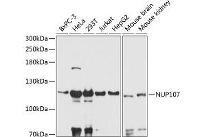 Western blot analysis of extracts of various cell lines, using NUP107 antibody (ABIN6129528, ABIN6144947, ABIN6144948 and ABIN6216980) at 1:3000 dilution. (NUP107 antibody  (AA 766-925))