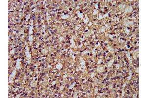 IHC image of ABIN7149912 diluted at 1:300 and staining in paraffin-embedded human adrenal gland tissue performed on a Leica BondTM system. (DLST antibody  (AA 76-225))