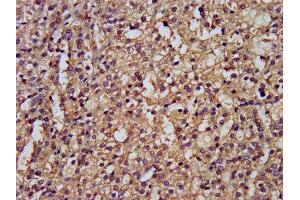 IHC image of ABIN7149912 diluted at 1:300 and staining in paraffin-embedded human adrenal gland tissue performed on a Leica BondTM system. (DLST antibody  (AA 76-225))