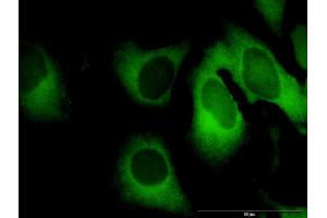 Immunofluorescence of purified MaxPab antibody to GBP1 on HeLa cell. (GBP1 antibody  (AA 1-592))