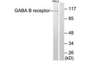 Western blot analysis of extracts from HeLa cells, using GABA-B Receptor Antibody. (GABBR1 antibody  (AA 871-920))
