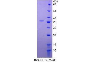 Image no. 1 for DnaJ (Hsp40) Homolog, Subfamily C, Member 12 (DNAJC12) (AA 1-183) protein (His tag) (ABIN4990872) (DNAJC12 Protein (AA 1-183) (His tag))