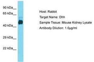 Image no. 1 for anti-Desert Hedgehog (DHH) (AA 74-123) antibody (ABIN6750459) (desert Hedgehog antibody  (AA 74-123))