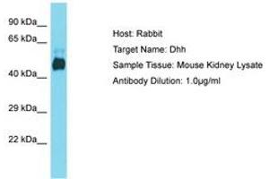 Image no. 1 for anti-Desert Hedgehog (DHH) (AA 74-123) antibody (ABIN6750459)
