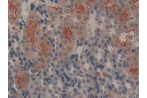 Detection of GAL9 in Mouse Kidney Tissue using Polyclonal Antibody to Galectin 9 (GAL9) (Galectin 9 antibody  (AA 225-353))