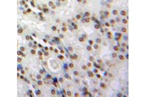 Used in DAB staining on fromalin fixed paraffin-embedded Kidney tissue (NMES1 antibody  (AA 1-83))