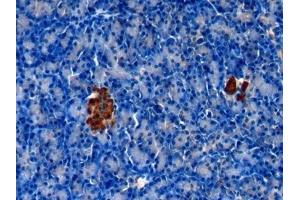 Immunohistochemistry (IHC) image for anti-Chromogranin A (CHGA) (AA 15-148) antibody (ABIN7433258)