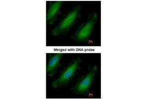 ICC/IF Image Immunofluorescence analysis of paraformaldehyde-fixed HeLa, using RPL13A, antibody at 1:200 dilution. (RPL13A antibody)