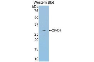 Western Blotting (WB) image for anti-Fascin (FSCN1) (AA 27-273) antibody (ABIN1174986) (Fascin antibody  (AA 27-273))