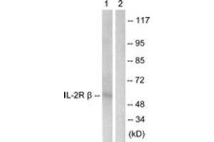 Western blot analysis of extracts from HepG2 cells, using IL-2R beta (Ab-364) Antibody.