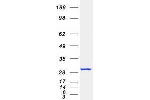 Proteasome Subunit alpha  7 (PSMA7) protein (Myc-DYKDDDDK Tag)
