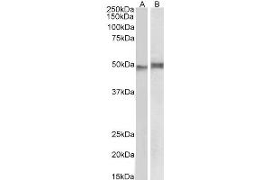 ABIN5872427 (1 µg/ml) staining of Mouse Thymus (A) and Pig Spleen (B) lysate (35 µg protein in RIPA buffer). (NCF1 antibody)