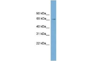 WB Suggested Anti-L3mbtl Antibody Titration:  0. (L3MBTL1 antibody  (Middle Region))