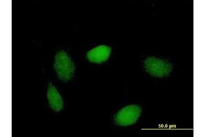 Immunofluorescence of purified MaxPab antibody to LSM1 on HeLa cell. (LSM1 antibody  (AA 1-133))