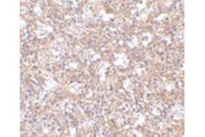 Immunohistochemistry of TEM4 in human spleen tissue with this product at 2. (ARHGEF17 antibody  (Center))