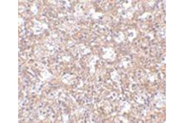 ARHGEF17 antibody  (Center)