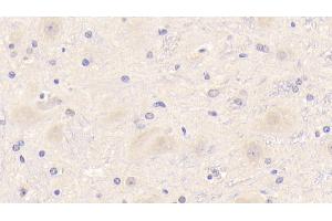 Detection of TREM2 in Mouse Cerebrum Tissue using Polyclonal Antibody to Triggering Receptor Expressed On Myeloid Cells 2 (TREM2) (TREM2 antibody  (AA 1-227))