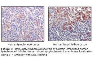 Image no. 1 for anti-Bruton Agammaglobulinemia tyrosine Kinase (BTK) antibody (ABIN232137) (BTK antibody)