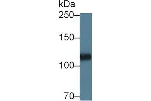 Western blot analysis of Pig Heart lysate, using Human HSPG2 Antibody (5 µg/ml) and HRP-conjugated Goat Anti-Rabbit antibody ( (HSPG2 antibody  (AA 4149-4391))