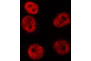 ABIN6276949 staining HepG2? (HOXA9 antibody  (Internal Region))