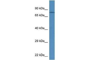 Western Blot showing Trpv6 antibody used at a concentration of 1. (TRPV6 antibody  (Middle Region))