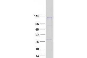 Validation with Western Blot