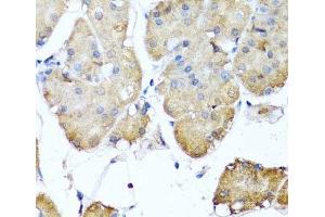 Immunohistochemistry of paraffin-embedded Human stomach using NIN Polyclonal Antibody at dilution of 1:100 (40x lens). (Ninein antibody)