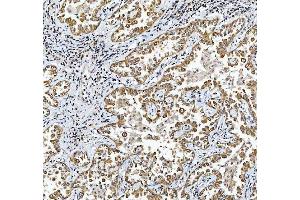 IHC analysis of TRIR using anti-TRIR antibody (ABIN7603244). (Uncharacterized Protein C19orf43 (TRIR) (N-Term) antibody)