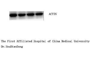 Western Blot (WB) analysis: Please contact us for more details. (beta Actin antibody  (N-Term))