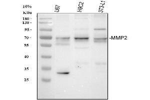 Western blot analysis of MMP2 using anti-MMP2 antibody (ABIN5518776).