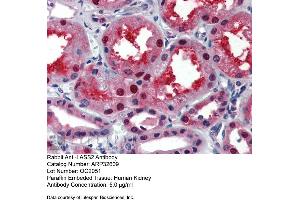 Immunohistochemistry with Human kidney lysate tissue at an antibody concentration of 5. (Ceramide Synthase 2 antibody  (N-Term))