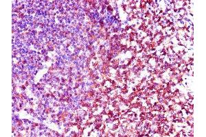 Immunohistochemistry of paraffin-embedded human tonsil tissue using ABIN7174038 at dilution of 1:100 (LCK antibody  (AA 1-539))