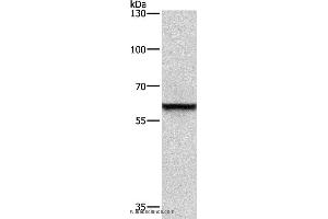 Western blot analysis of A431 cell, using TRIP4 Polyclonal Antibody at dilution of 1:400 (TRIP4 antibody)