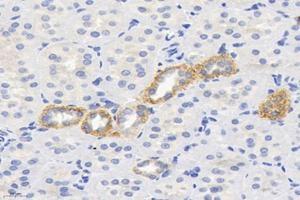 Immunohistochemistry analysis of paraffin-embedded rat kidney using,ME2 (ABIN7074757) at dilution of 1: 6000