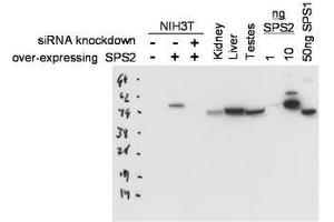 Image no. 1 for anti-Selenophosphate Synthetase 2 (SEPHS2) antibody (ABIN300064)