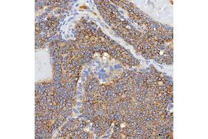 IHC analysis of SGCE using anti-SGCE antibody (ABIN7601544). (SGCE antibody  (AA 38-407))