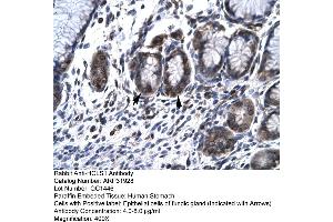 Rabbit Anti-HCLS1 Antibody  Paraffin Embedded Tissue: Human Stomach Cellular Data: Epithelial cells of Fundic Gland Antibody Concentration: 4. (HCLS1 antibody  (N-Term))