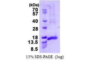SDS-PAGE (SDS) image for Centromere Protein H (CENPH) (AA 136-247) protein (His tag) (ABIN667555)