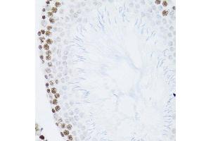 Immunohistochemistry (Paraffin-embedded Sections) (IHC (p)) image for anti-Nuclear Factor of kappa Light Polypeptide Gene Enhancer in B-Cells 2 (NFKB2) (AA 690-899) antibody (ABIN3017388)