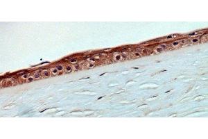 human cornea (courtesy of L. (KRT12 antibody)