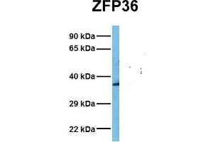 Host:  Rabbit  Target Name:  ZFP36  Sample Tissue:  Human Fetal Liver  Antibody Dilution:  1. (ZFP36 antibody  (N-Term))