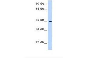 Image no. 1 for anti-Lipoic Acid Synthetase (LIAS) (C-Term) antibody (ABIN6738493) (LIAS antibody  (C-Term))